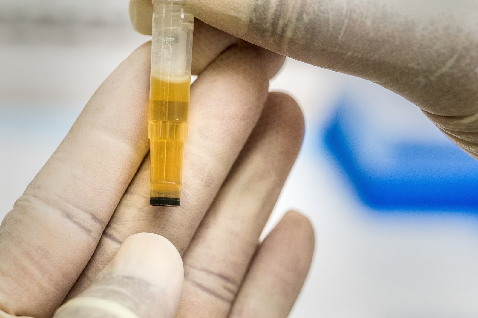 le test d'urine est possible pour une analyse