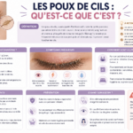 Les poux de cils : Qu’est-ce que c’est ? Définition